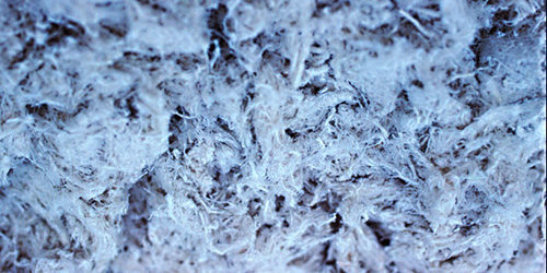 asbestosis_amianto