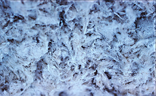 asbestosis_amianto